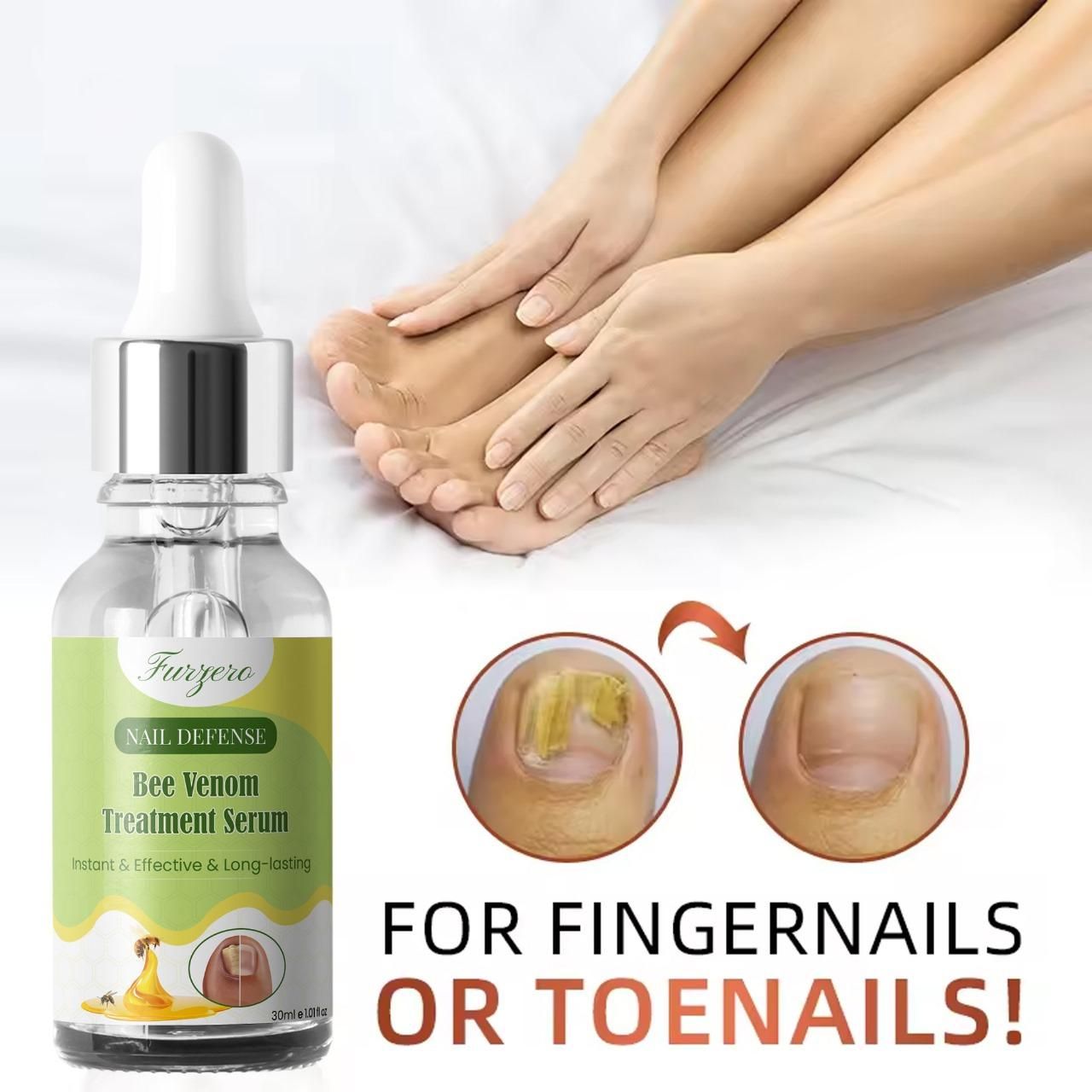 Furgero Nail Defense Bee Venom Treatment Serum 30ml(Pack Of 2) - OSAK ENTERPRISES
