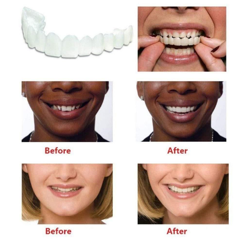 Instant and Confident on Smile Fit Flex Cosmetic Teeth Denture Teeth - OSAK ENTERPRISES